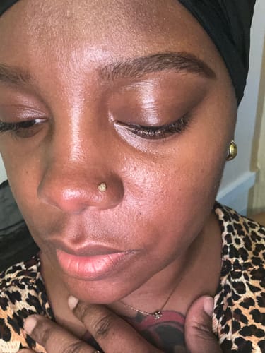 Customer photo review of Piercing Bump Treatment - Bump, Keloid & Scar Relief Oil