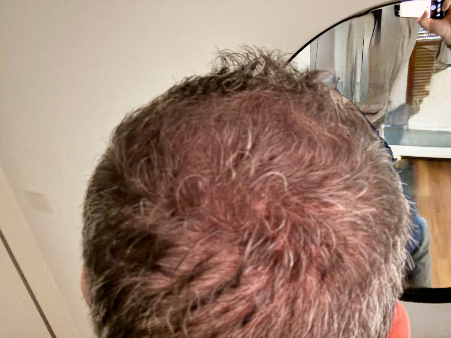 Customer photo review of FIBRE PER CAPELLI COTTONFIX TASCABILE 7 Gr