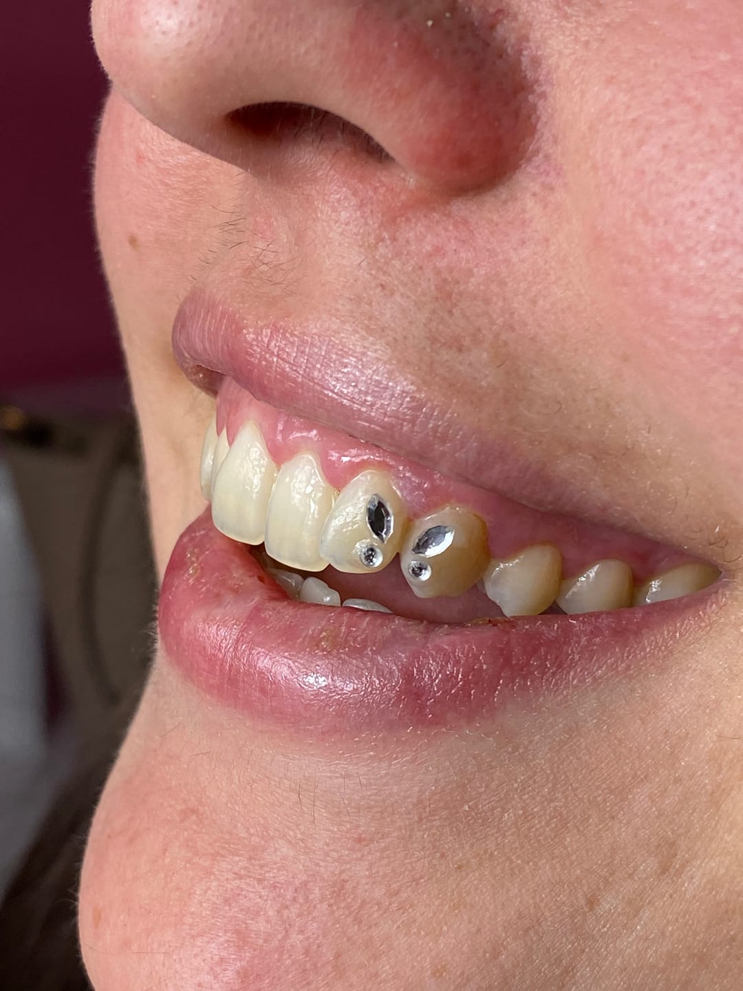 Customer photo review of Pack de 8 diseños de mariposa de gemas dentales Marquise SWAROVSKI® - Crystal/Crystal AB