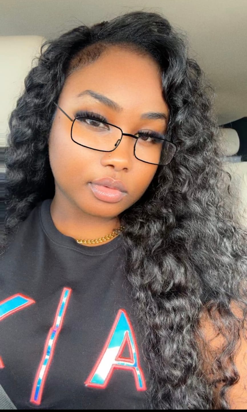 Customer photo review of Magic Eraser Dark Spot Cream