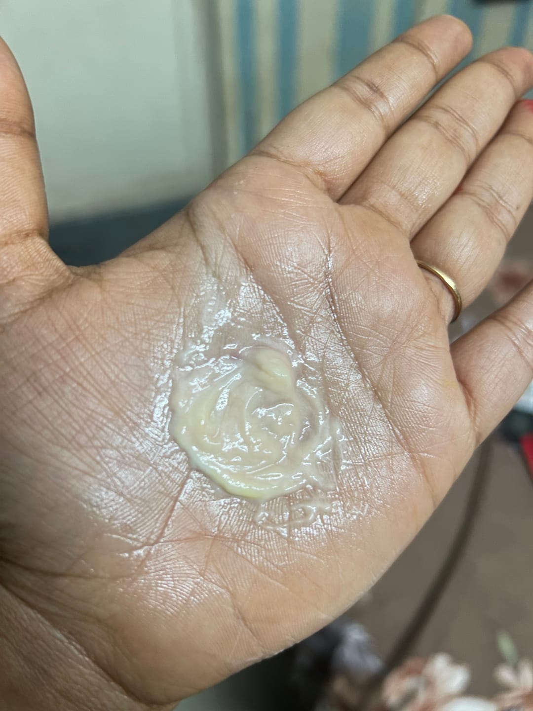 Customer photo review of Yuderma Melarid De-Pigmenting Serum