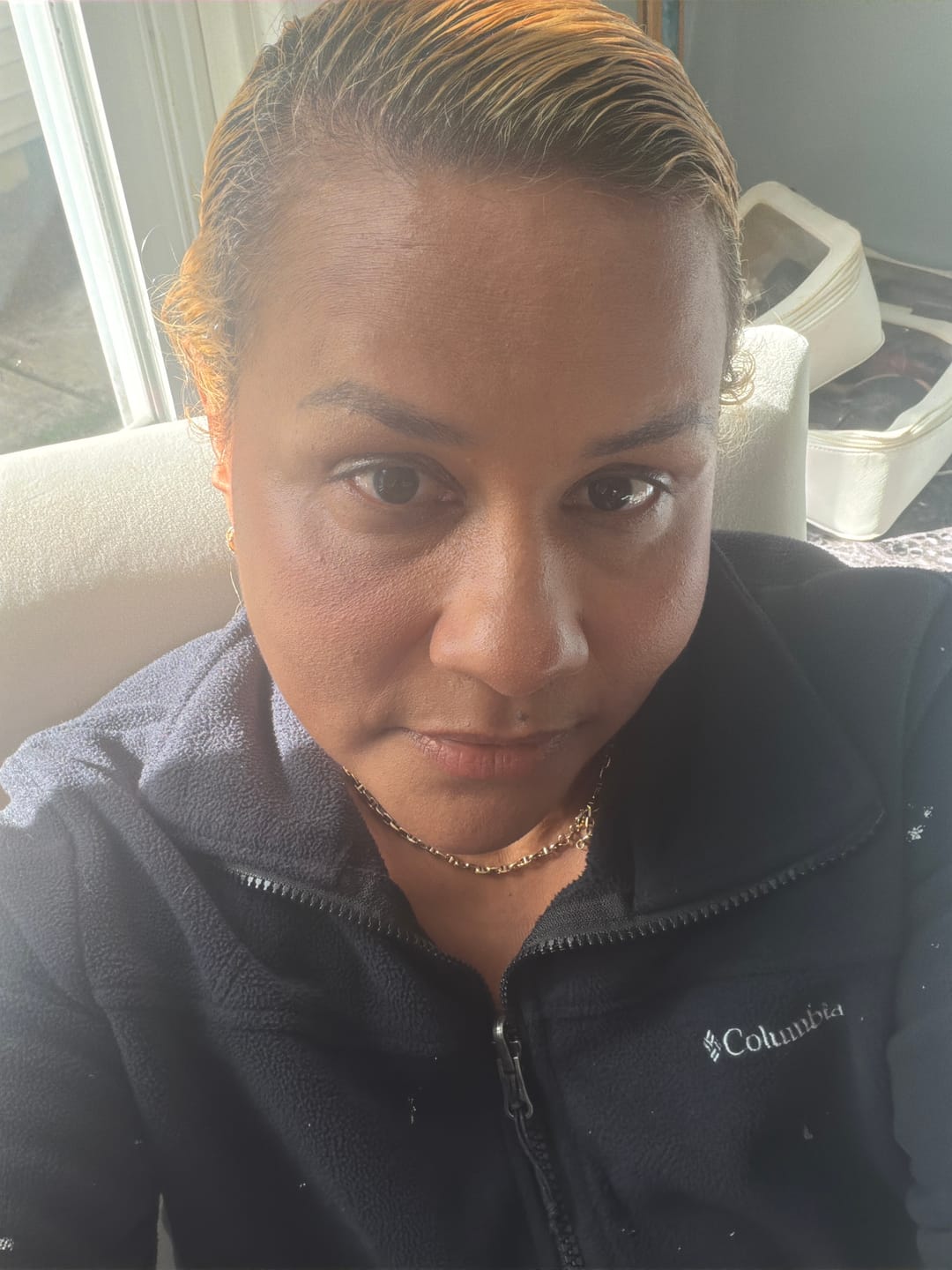 Customer photo review of Expert Madeca Cream Active Renew PDRN 50ml