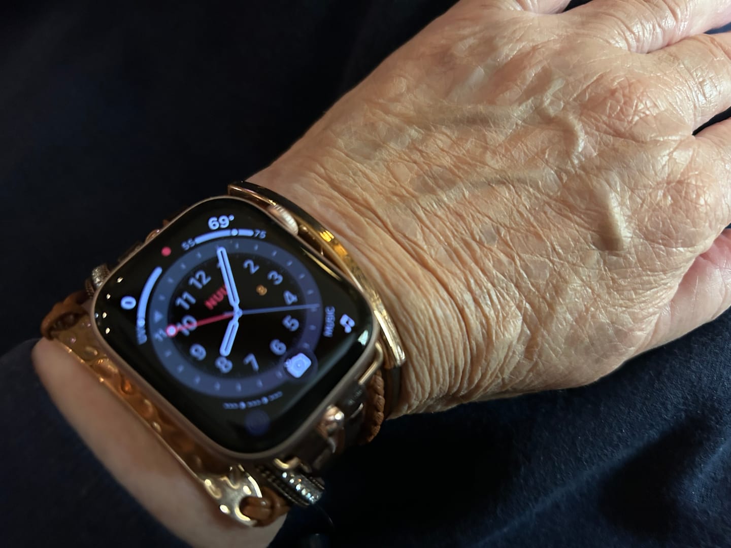 Customer photo review of The Posh Watch Band for Apple Watch