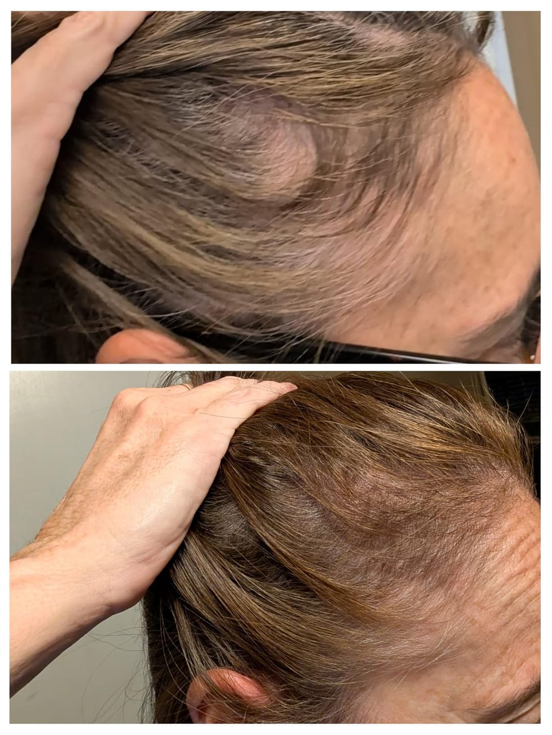 Customer photo review of Luxea - The #1 Natural Solution for Thicker Thicker, Fuller Hair After 40
