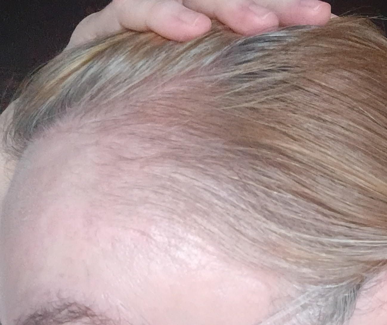 Customer photo review of Luxea - The #1 Natural Solution for Thicker Thicker, Fuller Hair After 40