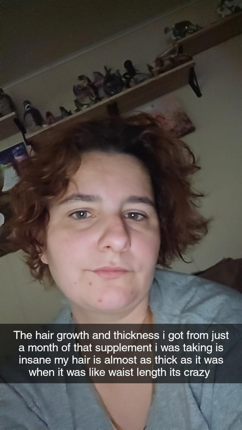 Customer photo review of Luxea - The #1 Natural Solution for Thicker Thicker, Fuller Hair After 40