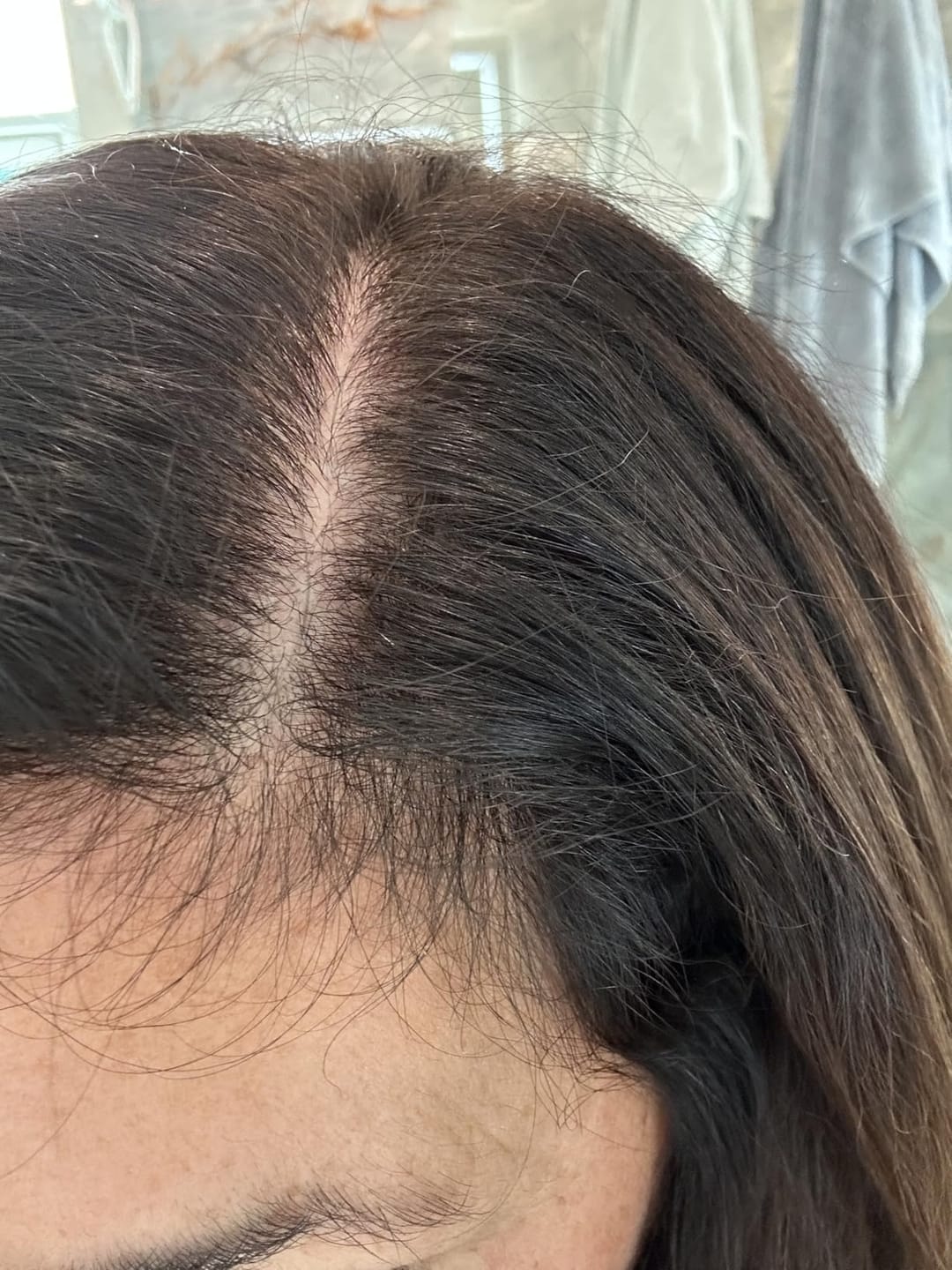 Customer photo review of Luxea - The #1 Natural Solution for Thicker Thicker, Fuller Hair After 40