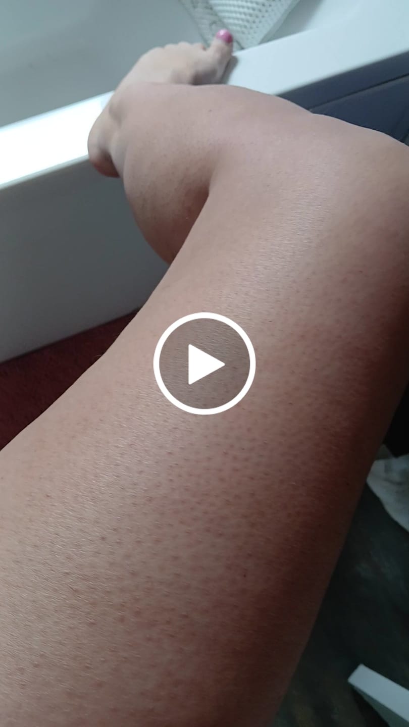 Customer video review of Anti-Cellulite Massage Oil (Collagen & Stem Cell Infused)