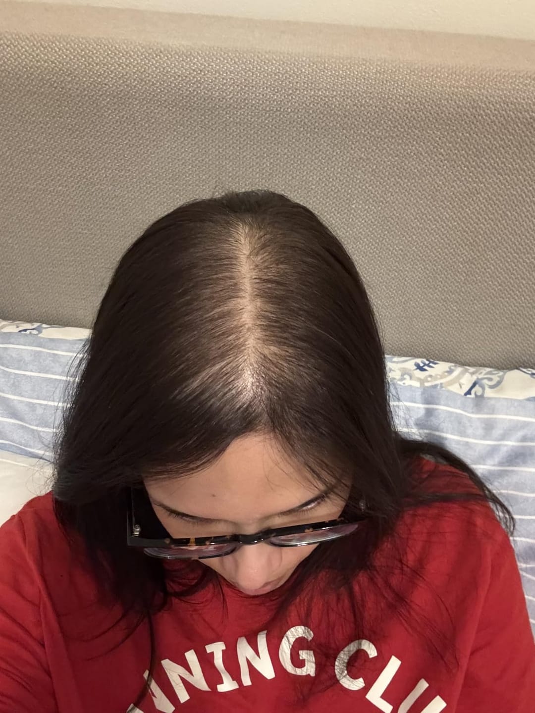 Customer photo review of Luxea - The #1 Natural Solution for Thicker Thicker, Fuller Hair After 40