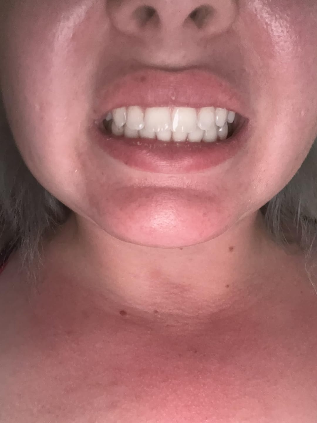 Customer photo review of The Root™