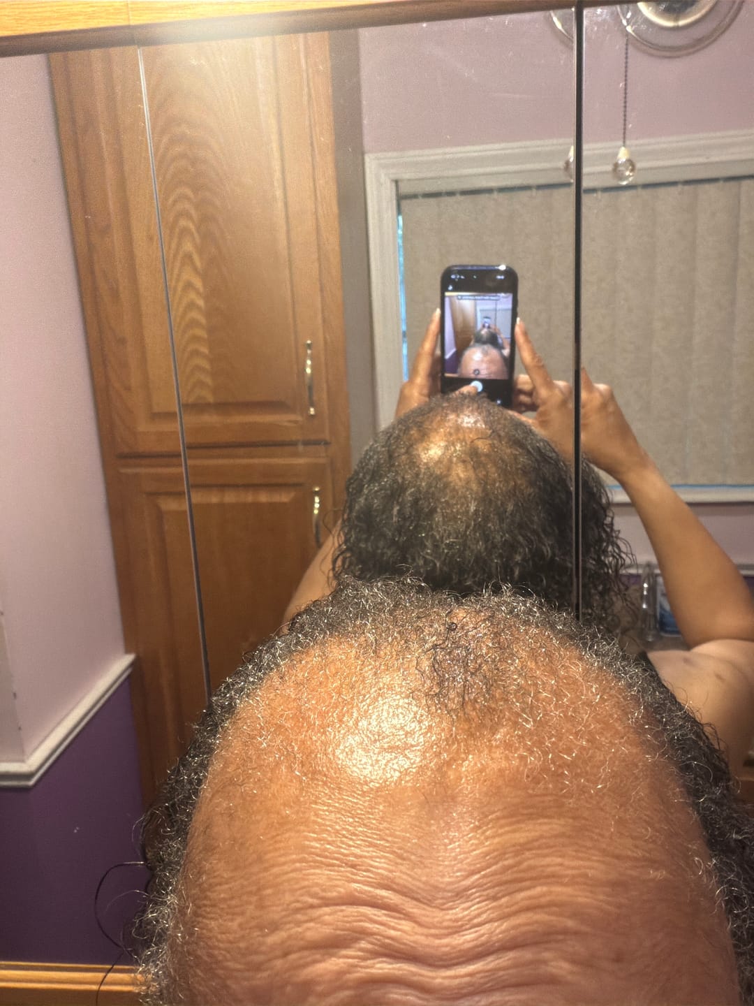 Customer photo review of Rennora Hair Growth Serum