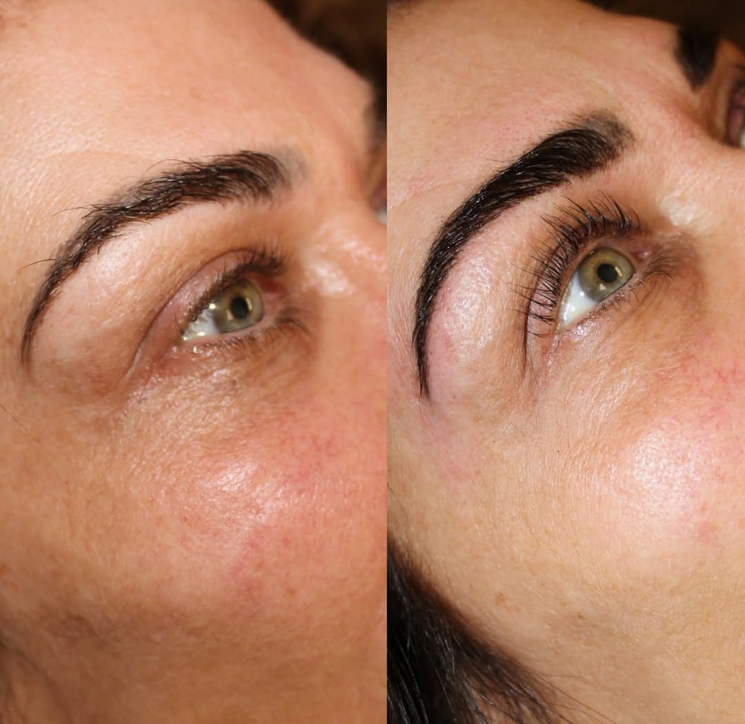 Customer photo review of Lash Growth Serum