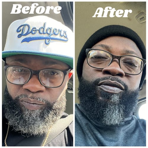 Customer photo review of New Complete Beard Care Kit