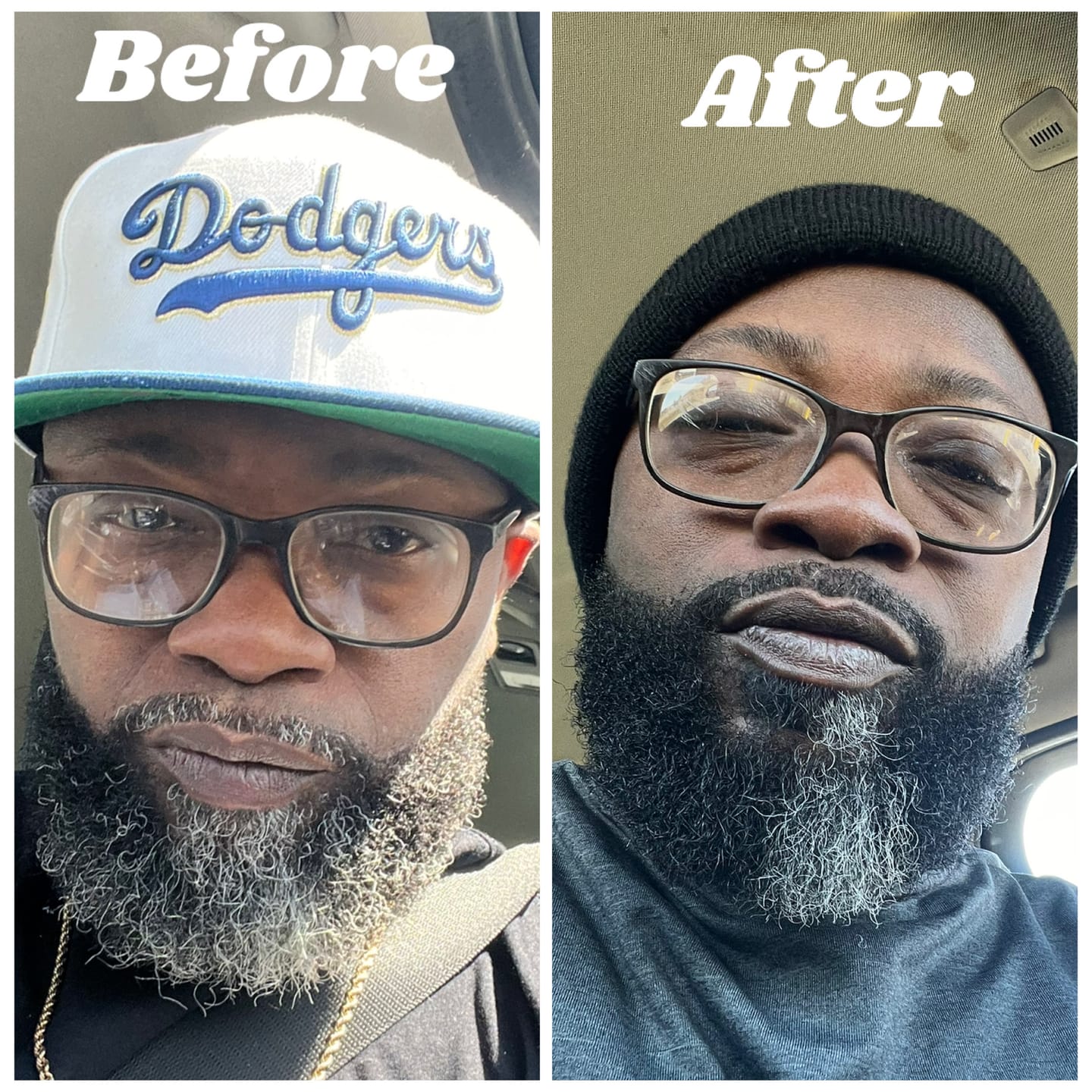 Customer photo review of New Complete Beard Care Kit