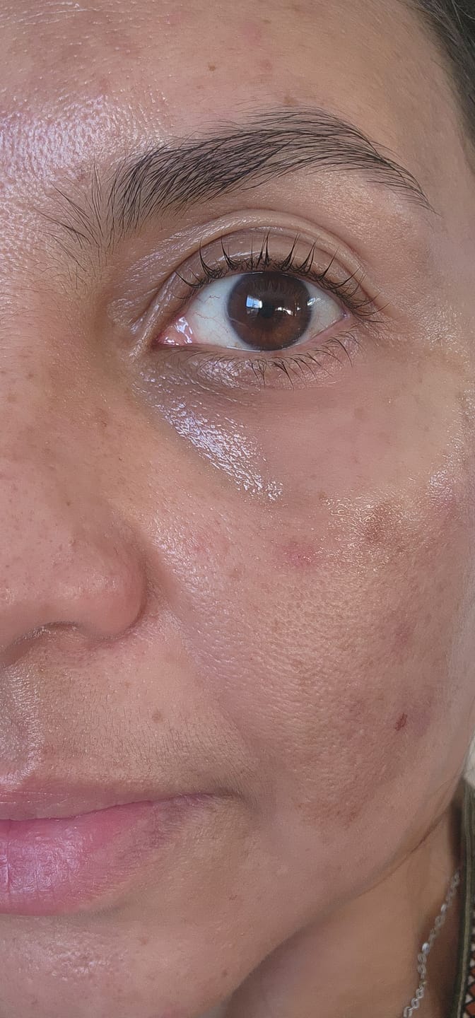 Customer photo review of The Naked Skin™ Bounce Balm