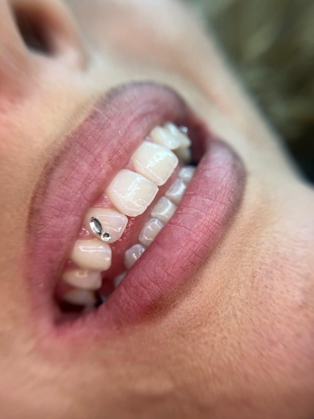Customer photo review of Pack de 8 diseños de mariposa de gemas dentales Navette SWAROVSKI® - Crystal/Crystal AB