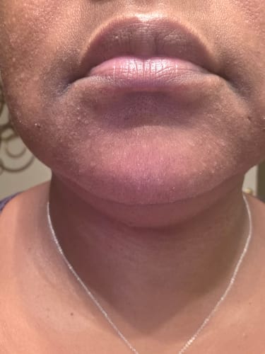 Customer photo review of Brightening Lip Bundle