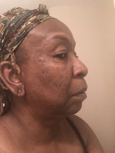 Customer photo review of Turmeric Brightening Soap (with Vitamin C, Alpha Arbutin, Oat)