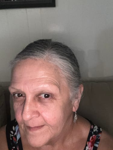 Reviewer showing a close-up of their face after using Koriderm™ Time Reverse Cream.