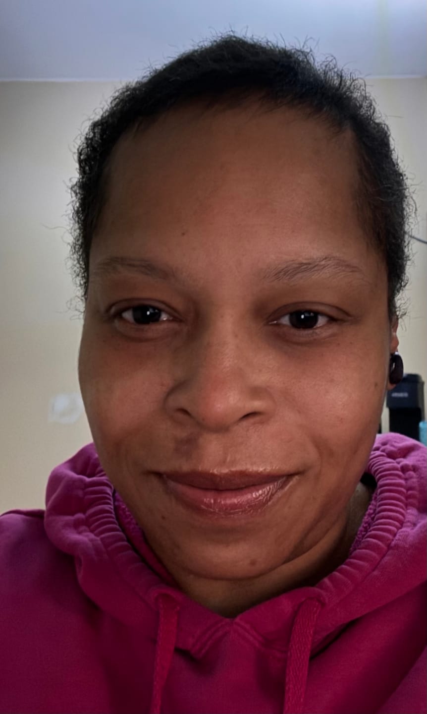Customer photo review of BALM- Stimulating Scalp and Hair Balm