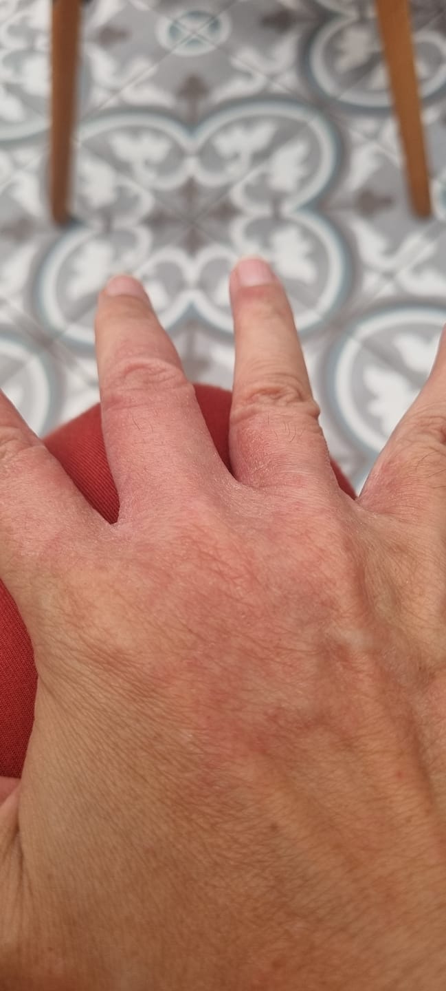 Customer photo review of Harmony Combo Pack - Holistic Care for Excellent Skin Wellness