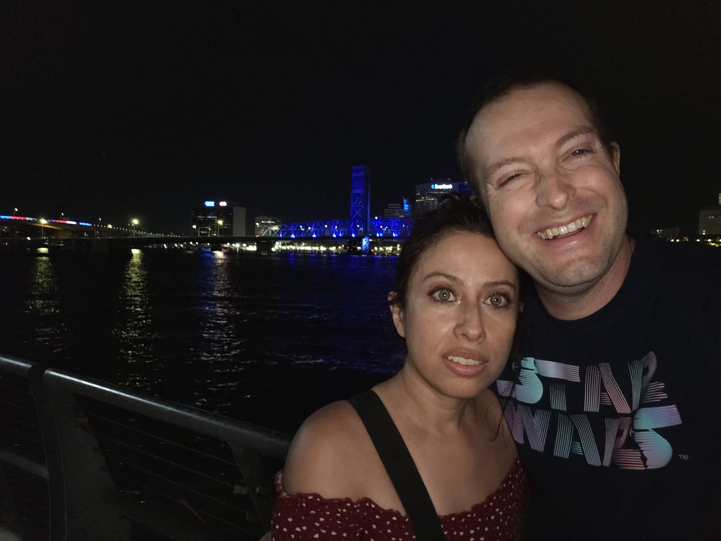 Customer photo review of Citha Hazel Brown Prescription Colored Contact Lenses