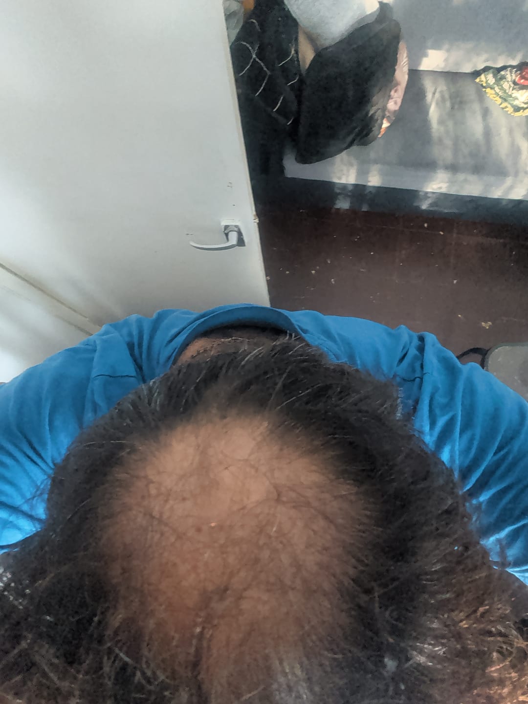 Customer photo review of Anti-Hair Loss Soap | 12 Natural Korean Plants