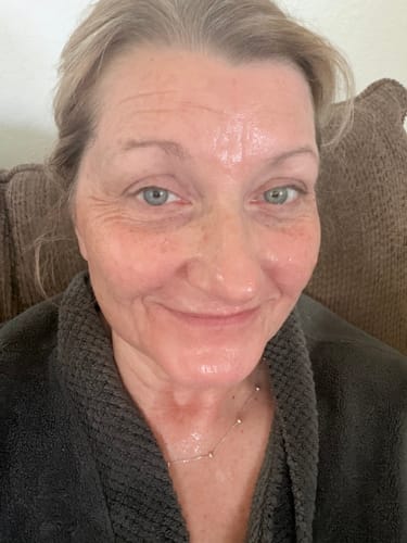 Customer showing her glowing face after treatment with the Seranova Micro Infusion System.