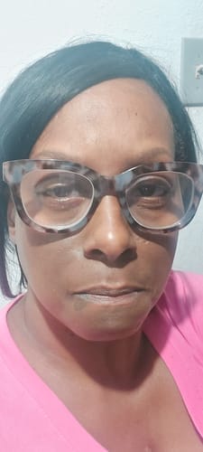 Customer photo review of Turmeric Brightening Soap (with Vitamin C, Alpha Arbutin, Oat)