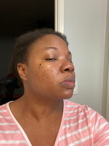 Customer photo review of Brightening Duo
