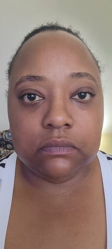 Customer photo review of Brightening Duo