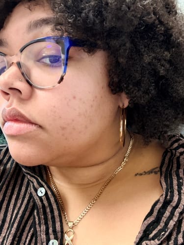 Customer photo review of Melanin Skin Bundle (40% off)