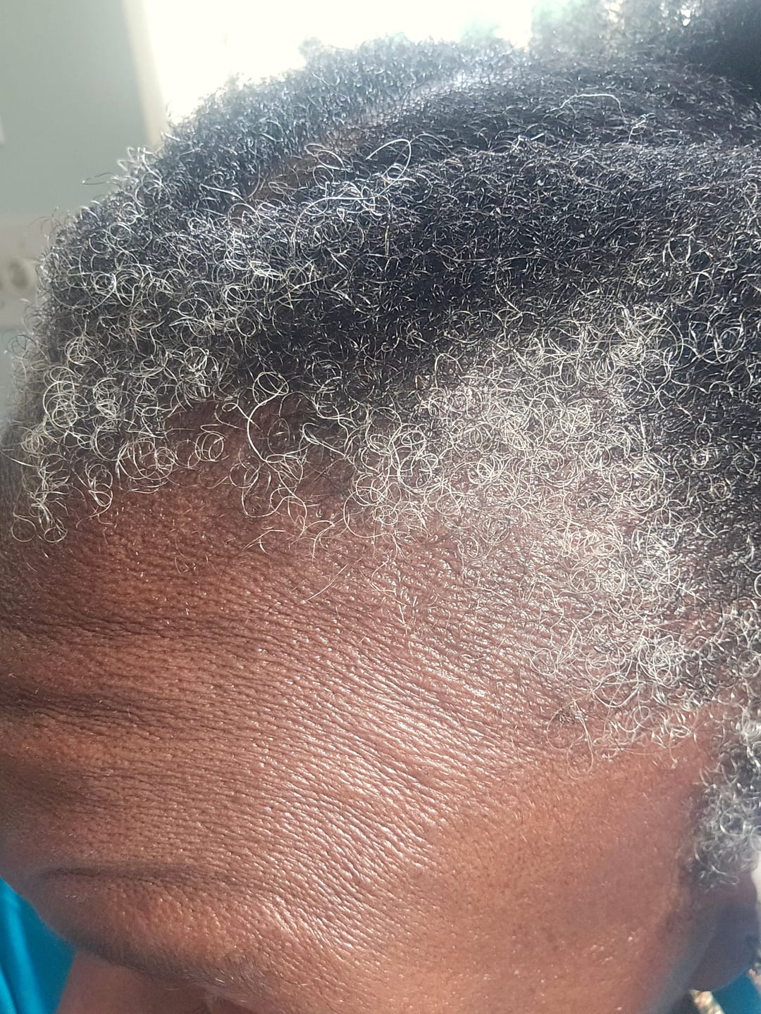 Customer photo review of Rennora Hair Growth Serum