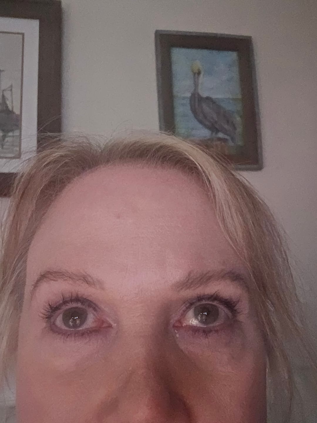 Customer photo review of Eyelash Serum