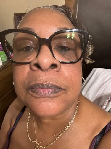 Customer photo review of Brightening Lip Bundle