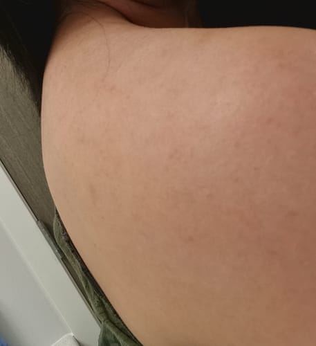 Customer photo review of Brightening Duo