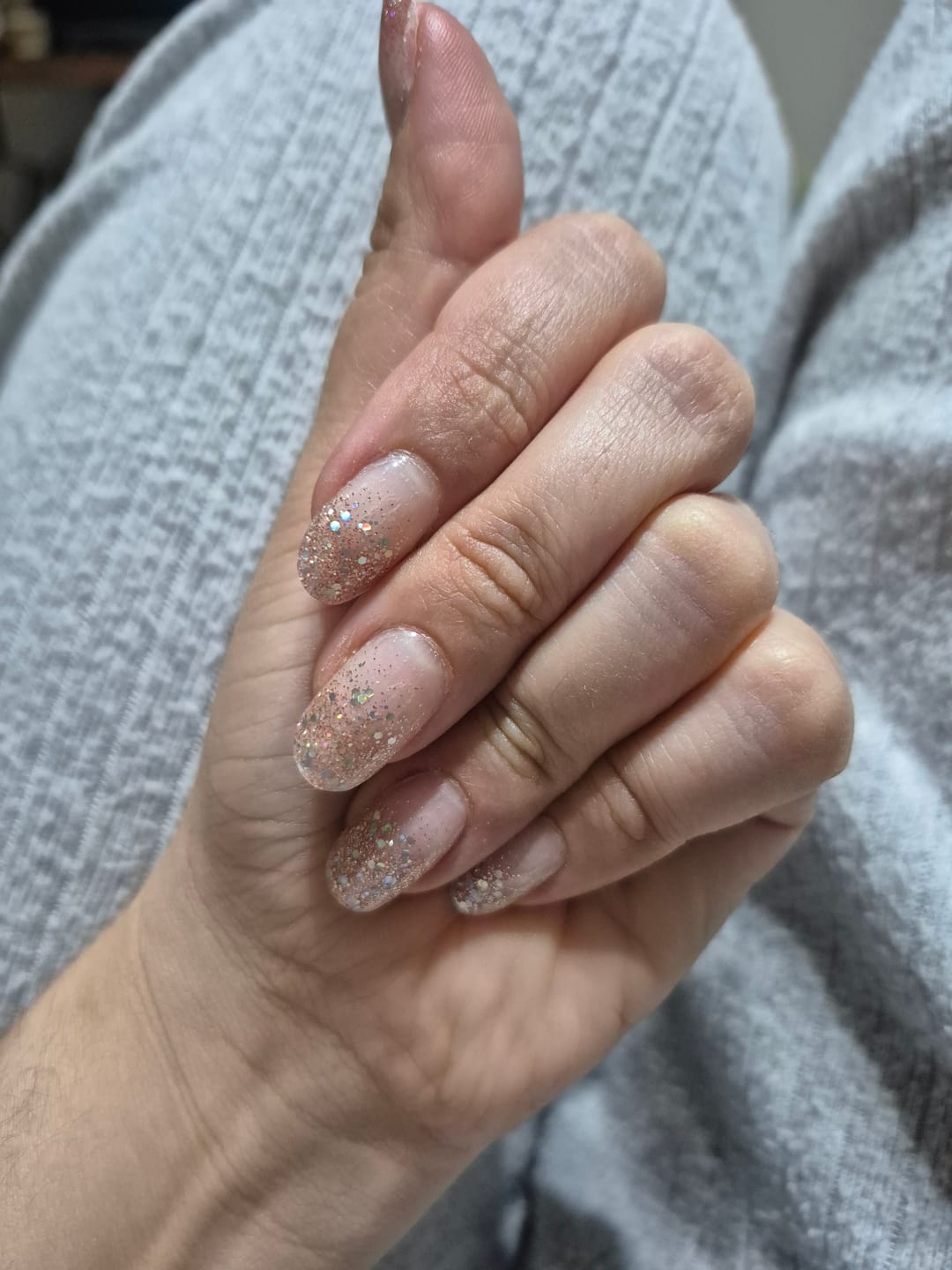 Customer photo review of N Sparkle Glam Jel Tırnak 30 Adet, 2 Kullanım