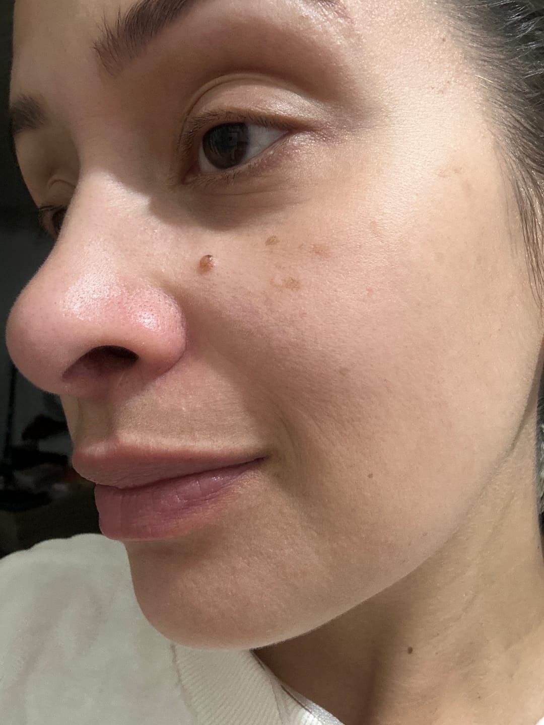 Customer photo review of Solução Vitamina C