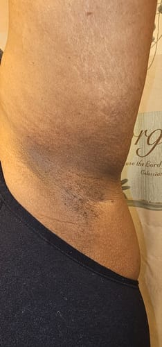Customer photo review of Brightening Duo