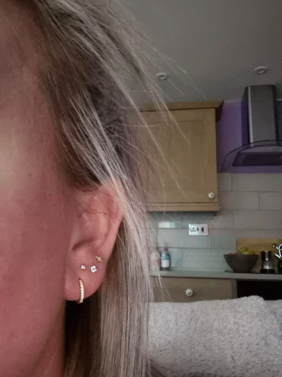 Customer photo review of ANGEL Eternity Cartilage Hoop (16g)