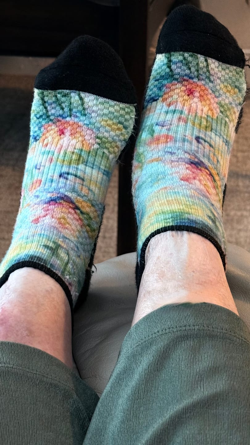 Customer photo review of Floral Ankle Compression Socks