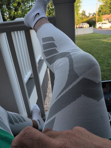 Customer photo review of Compression Sleeves V2 for Knees and Legs