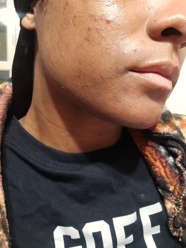 Customer photo review of Brightening Duo