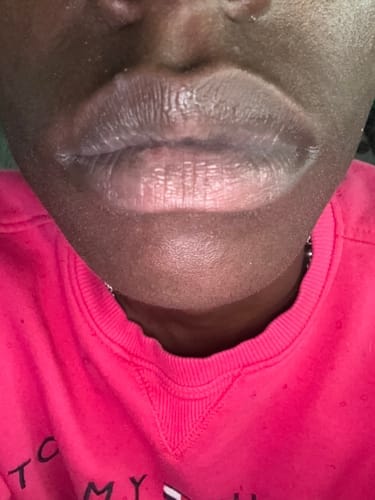 Customer photo review of Brightening Lip Bundle