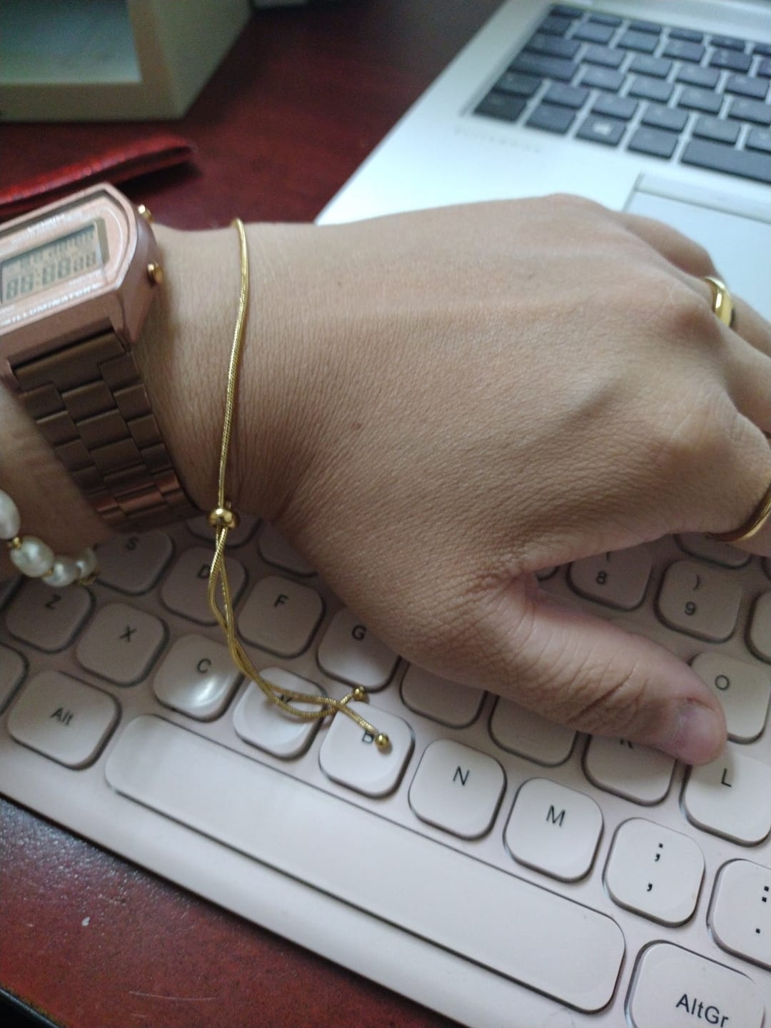 Customer photo review of Pulsera Icy