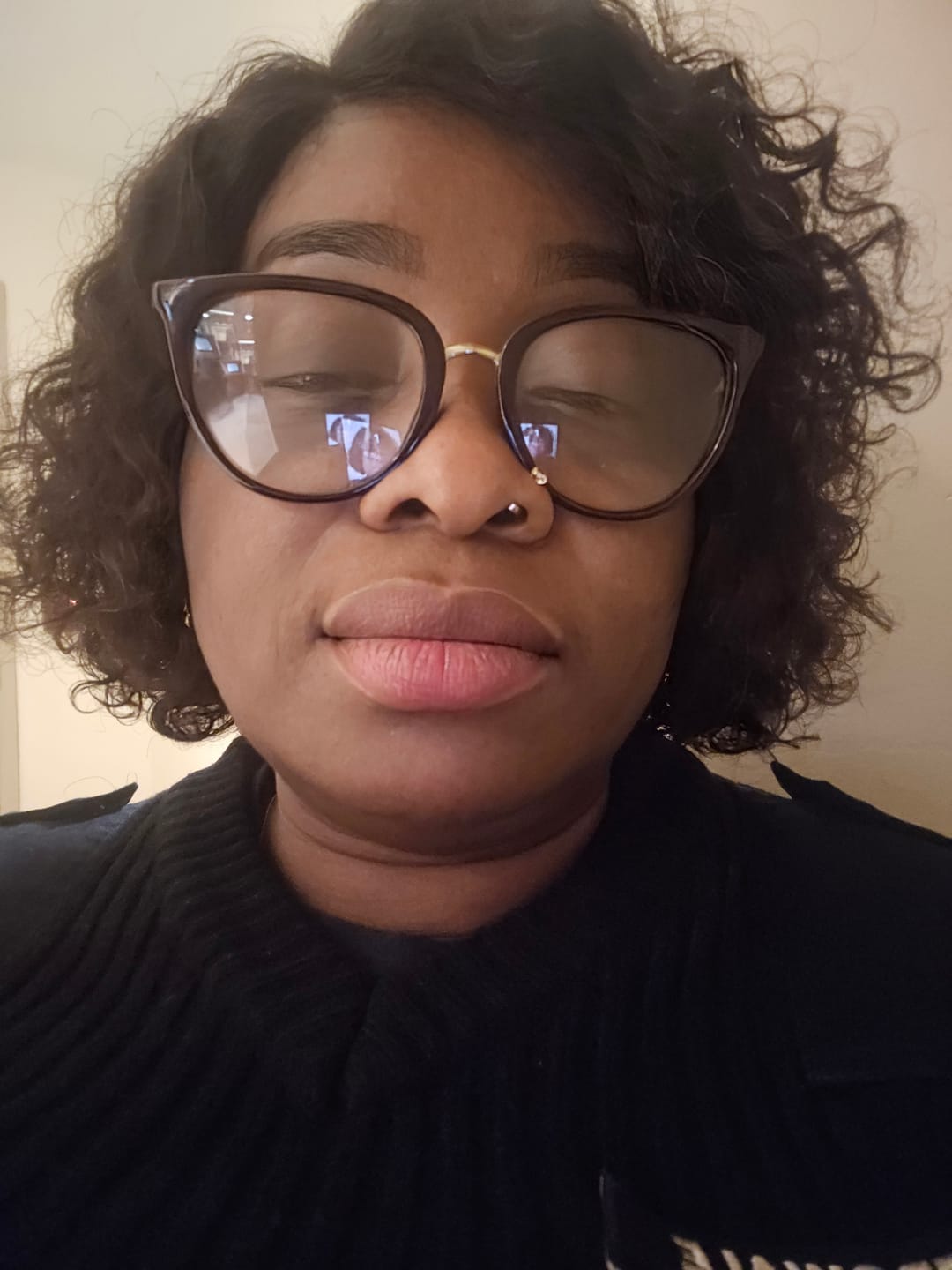 Customer photo review of Lips Lightening Cream For Men and Women (Results in 5 Days or Less)