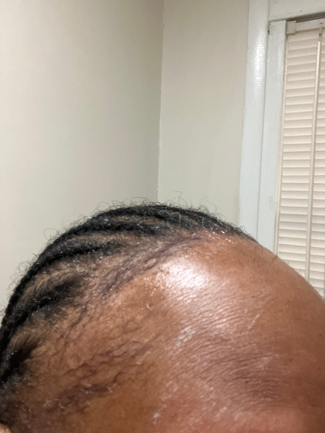 Customer photo review of Super Hair Growth Serum