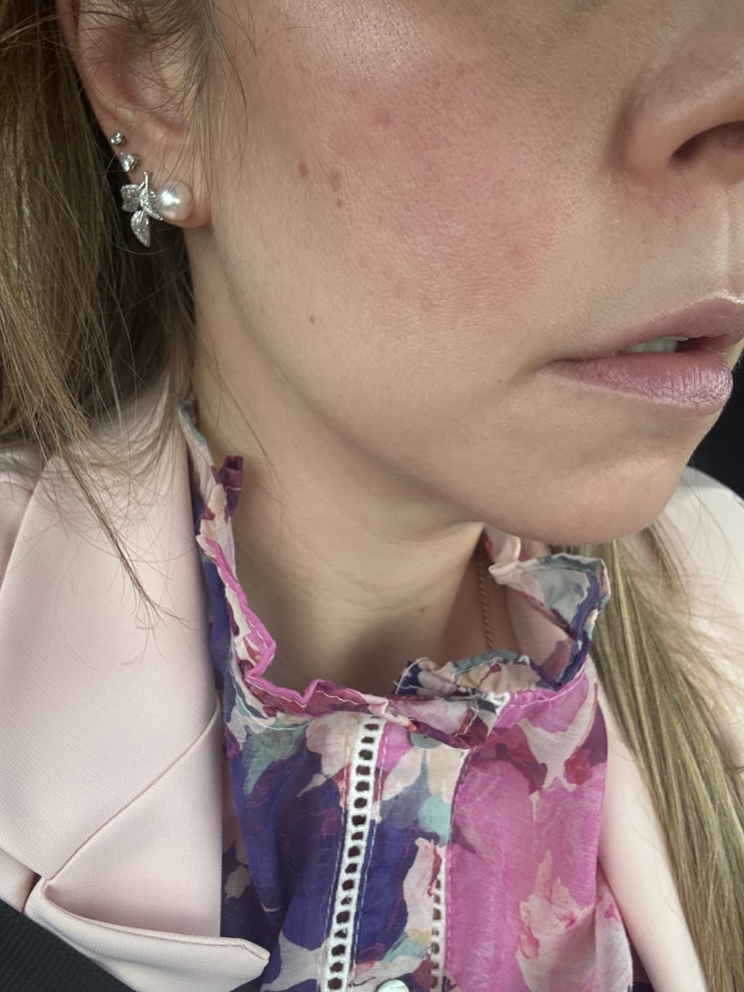 Customer photo review of Siero Viso Acido Ialuronico + Vitamina C