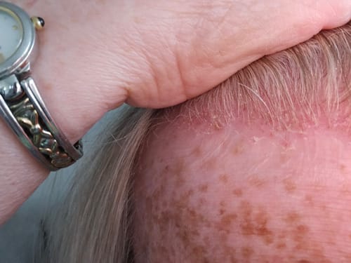 Customer photo review of Seb Natural Calming Serum