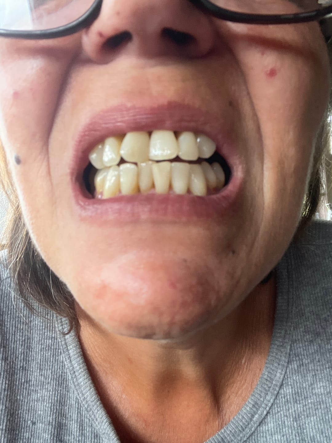 Customer photo review of PerioSafe® mundskyl + tandpasta med MicroSilver, sampak
